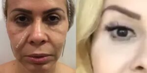 Imagem do post Procedimento no rosto realizado por Joelma a faz rejuvenescer 20 anos e foto de antes e depois choca
