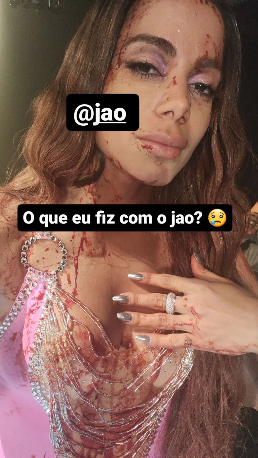 Anitta publicou a foto acima no instagram, ensanguentada com Jão (Reprodução - Instagram)