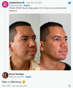 Internautas não gostaram do resultado da harmonização facial do ex-BBB23 (Foto: Reprodução / Twitter)