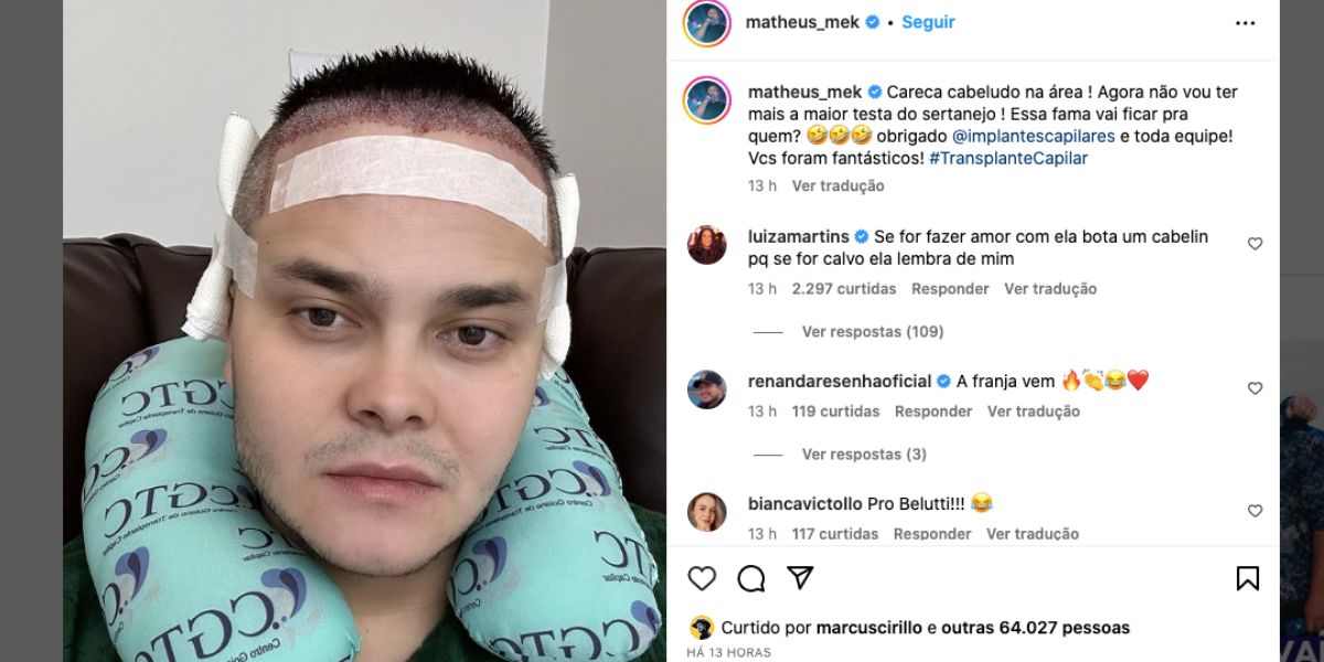 Matheus faz transplante capilar (Foto: Reprodução / Instagram) 