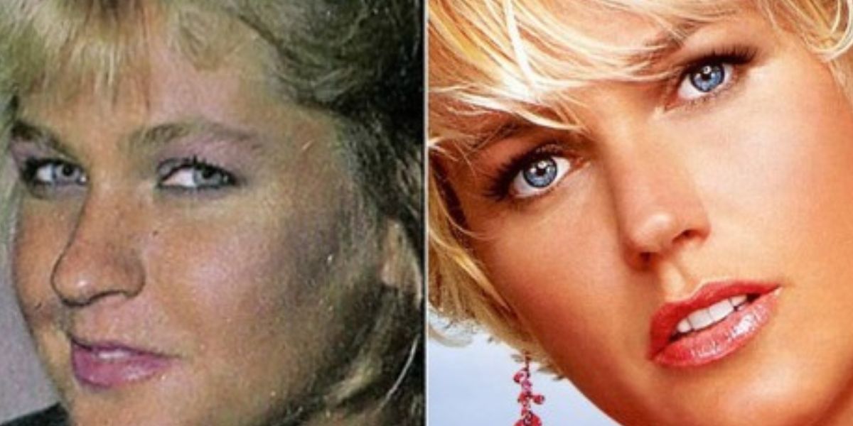 Antes e depois de nariz de Xuxa (Foto: Reprodução / Extra)