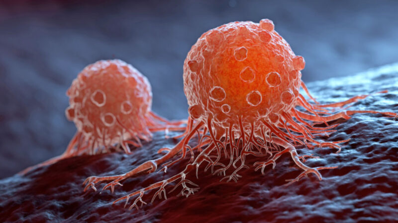 Stomach cancer is often silent (Image: Reproduction)
