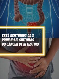 Esses são os 3 principais sintomas do câncer de intestino 	que você precisa saber (Foto - Montagem TV Foco).