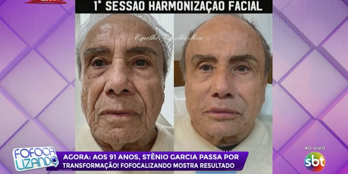 Antes e depois de Stênio Garcia (Foto: Reprodução/SBT)