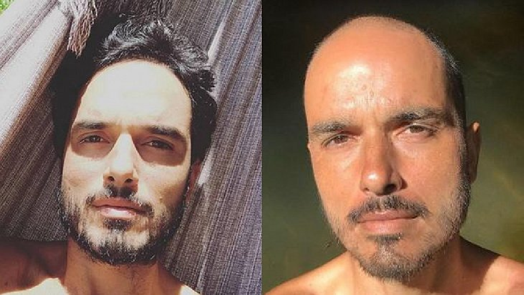 Antes e depois do ator (Foto: Reprodução/ Internet)