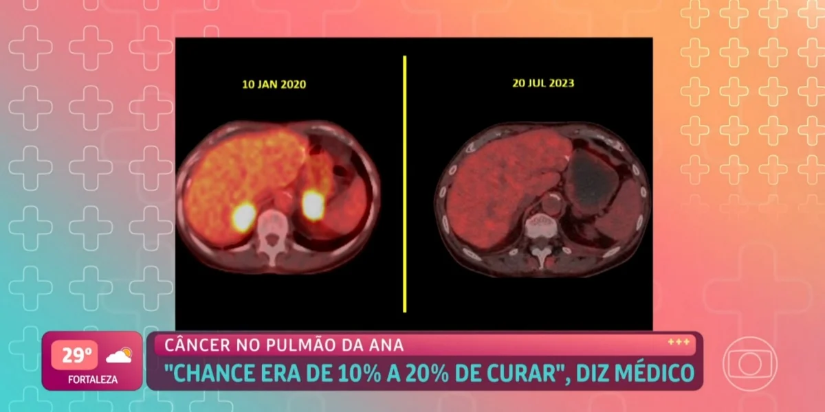 Imagens de alguns exames de Ana Maria (Foto: Reprodução/ Internet)