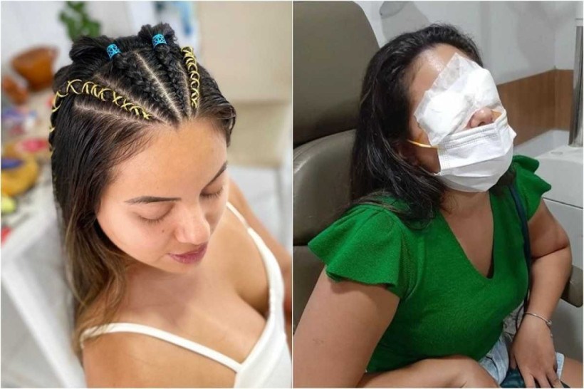 Jovem perdeu a visão ao usar pomada para modelar cabelo (Foto: Reprodução, Internet)