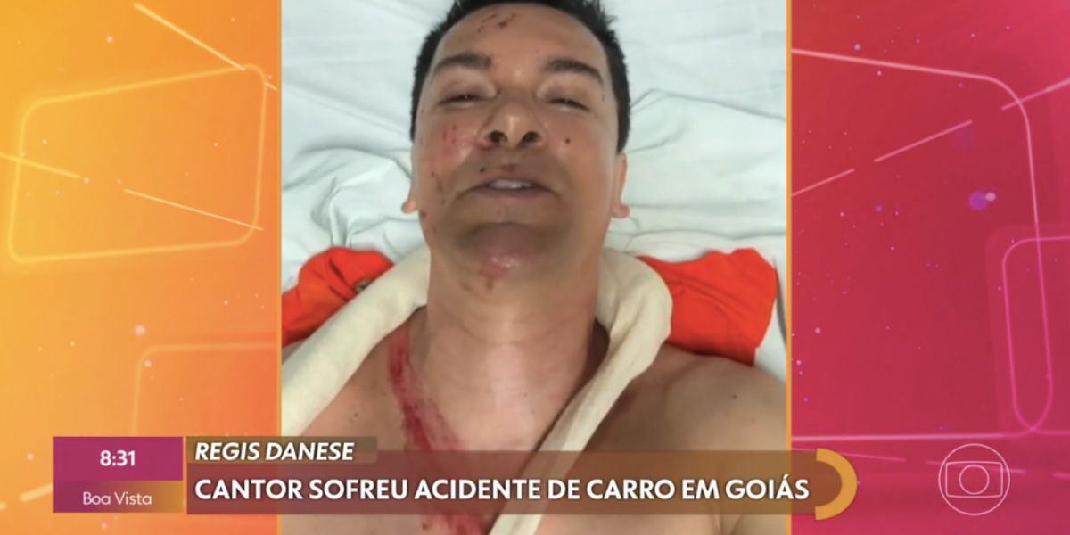 Cantor Regis Danese após acidente de carro (Foto: Reprodução / Encontro da Globo)