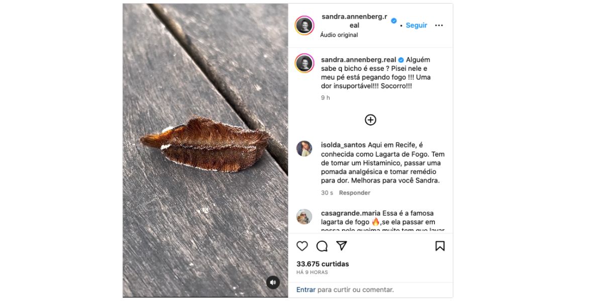 Bicho ataca Sandra Annenberg (Foto: Reprodução / Instagram) 