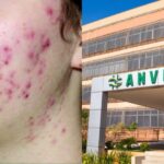 Anvisa baixa o facão e proibição em 5 produtos queridinhos - Foto: Montagem