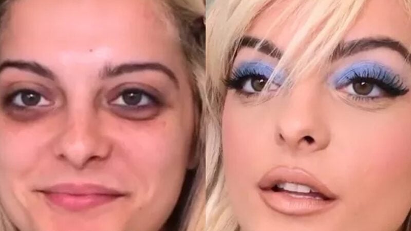 Before and after singer Bebe Rexha (Photo: Reproduction, Instagram)