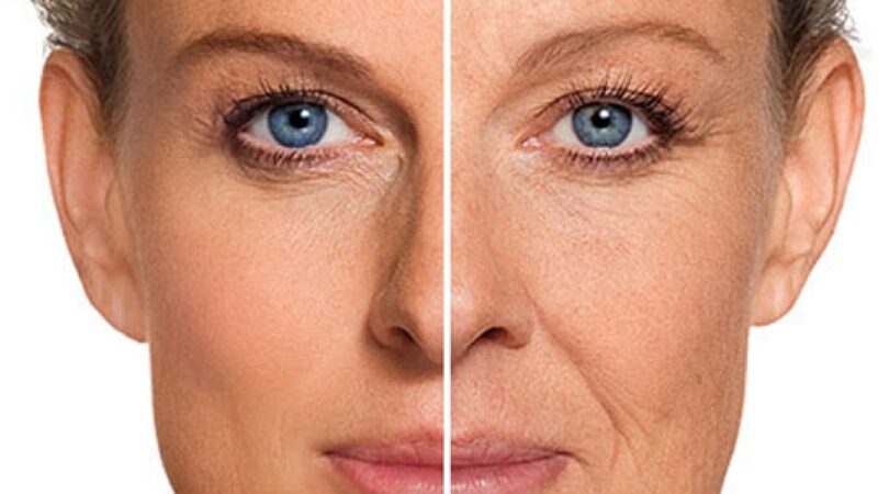 Before and after getting wrinkle-free skin (Image: Clone/Internet)