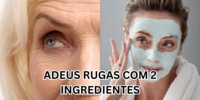 Adeus às rugas. Foto: Reprodução/Internet