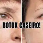 Receitinha de botox caseiro só com 4 ingredientes (Reprodução/Montagem TV Foco)