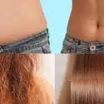 Barrica Inchada / Barriga seca / Cabelo ressecado / Cabelo liso - Montagem TVFOCO