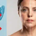 Receitinha mais forte que botox para dar fim às rugas (Foto: Reprodução/ Internet)