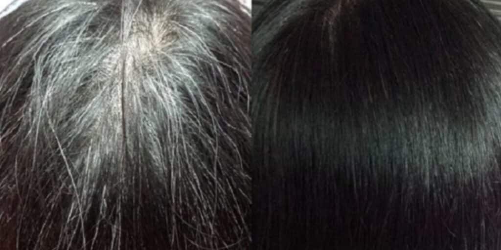 Cabelo grisalhos e preto: uma receita caseira ideal (Foto: Reprodução/ Internet)