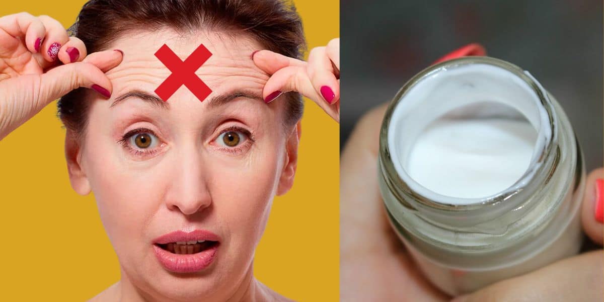 Expression lines and home cream to avoid Botox - (Online reproduction)