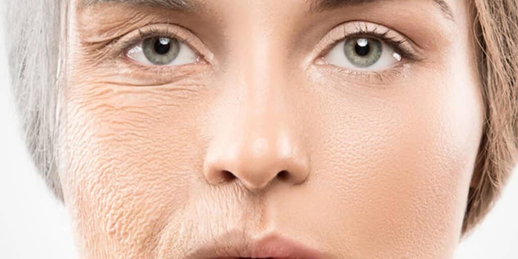 Pele sem e com colágeno (Foto: Reprodução- Cosmetici Inovation)