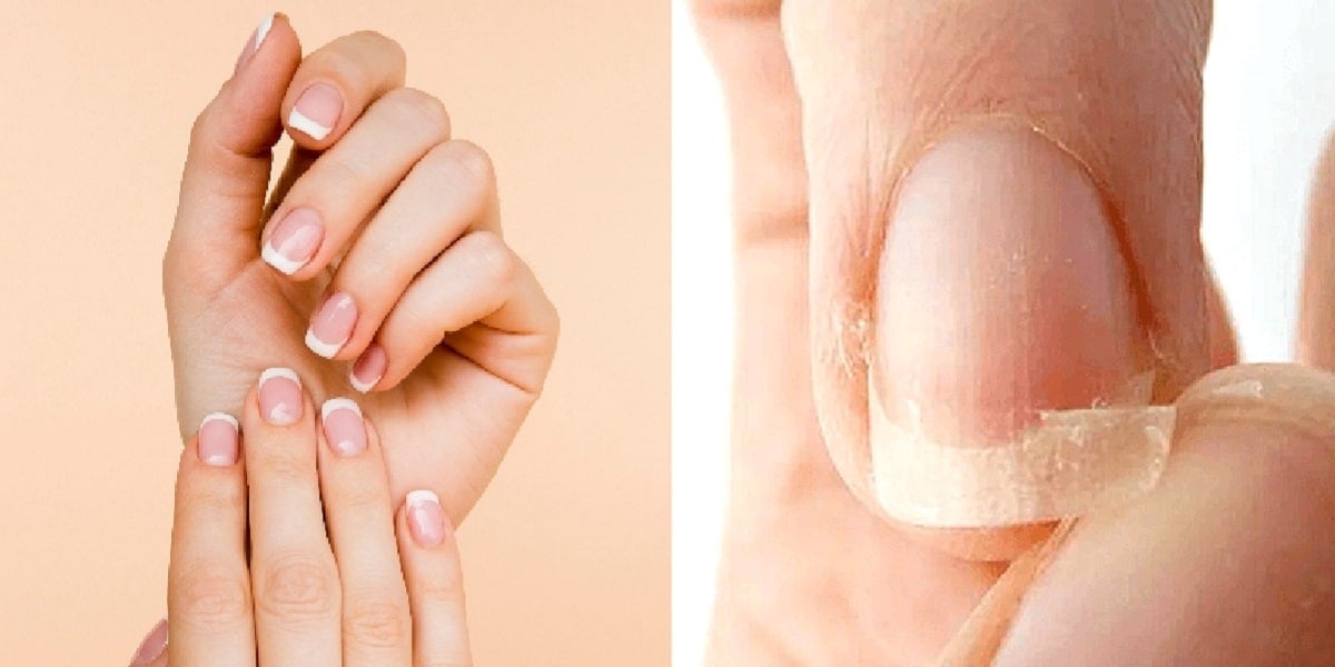 Unhas perfeitas e quebradiças (Foto: Reprodução/ Internet)