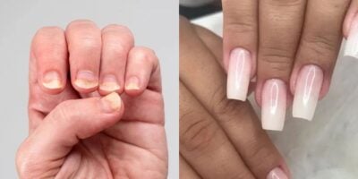 Unhas quebradiças / Unhas alongadas - Montagem TVFOCO