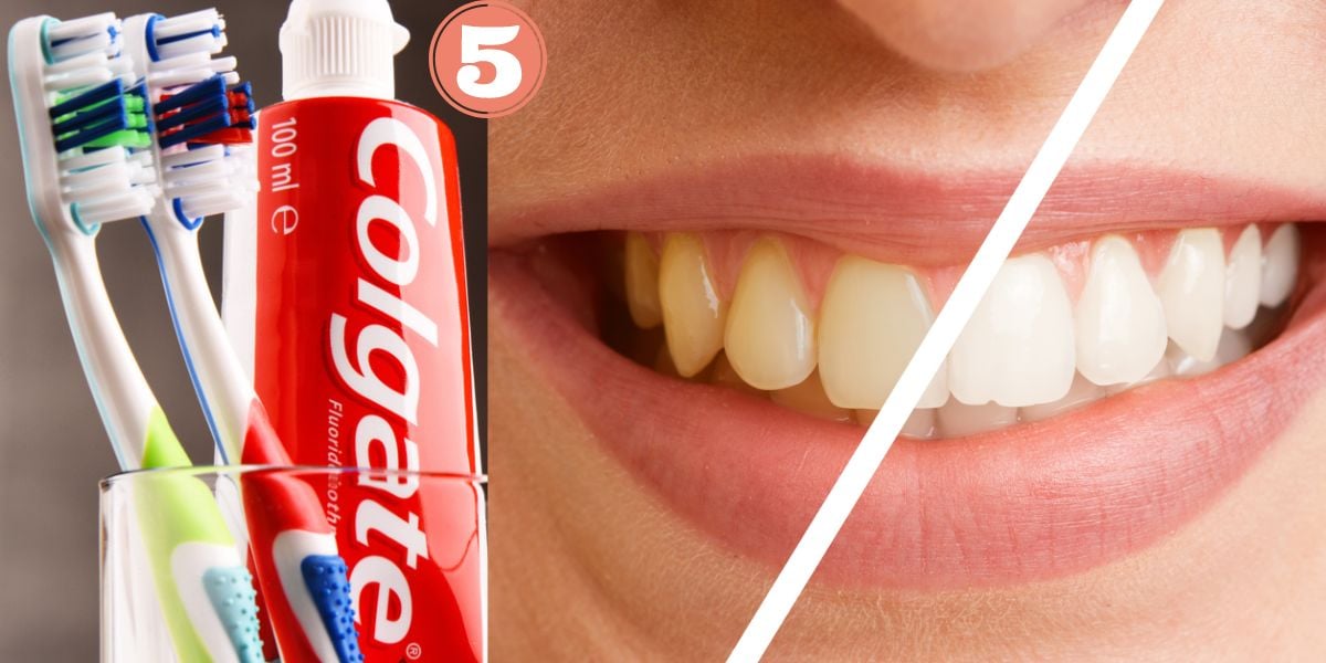 Colgate e clareamento dos dentes (Foto: Reprodução / Canva)