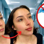 Harmonização facial pode ser conquistada sem cirurgia e com apenas 2 ingredientes (Foto Reprodução/Montagem/Lennita/Tv Foco/MAGG/Canva)