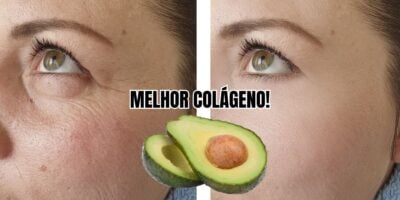 Melhor colágeno do mundo com abacate + 2 deixa pele lisinha (Reprodução/Montagem/Canva)