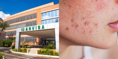 ANVISA confirma proibição contra 5 queridinhos das mulheres (Reprodução/Montagem/BoaConsulta)