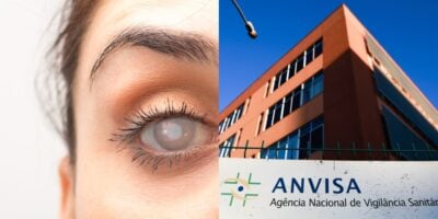 Anvisa crava proibição contra produto que pode causar cegueira (Foto: Reprodução/ Internet)