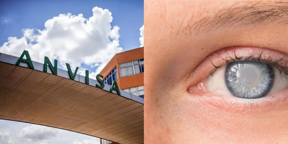 Anvisa proíbe produto popular capilar que pode causar cegueira temporária (Foto: Reprodução/ Internet)