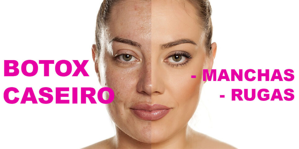 Botox caseiro - Rugas e Manchas (Foto: Reprodução - Drogaria Vera Cruz)