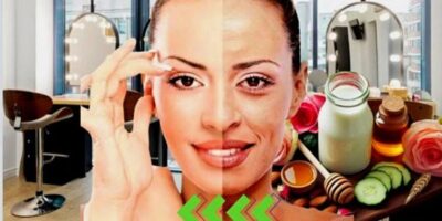 Imagem do post Fim das rugas e pele rachada: Harmonização facial com único ingrediente faz mulheres voltarem aos 20 anos