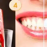 Colgate e dente sem e com clareamento (Foto: Reprodução / Canva)