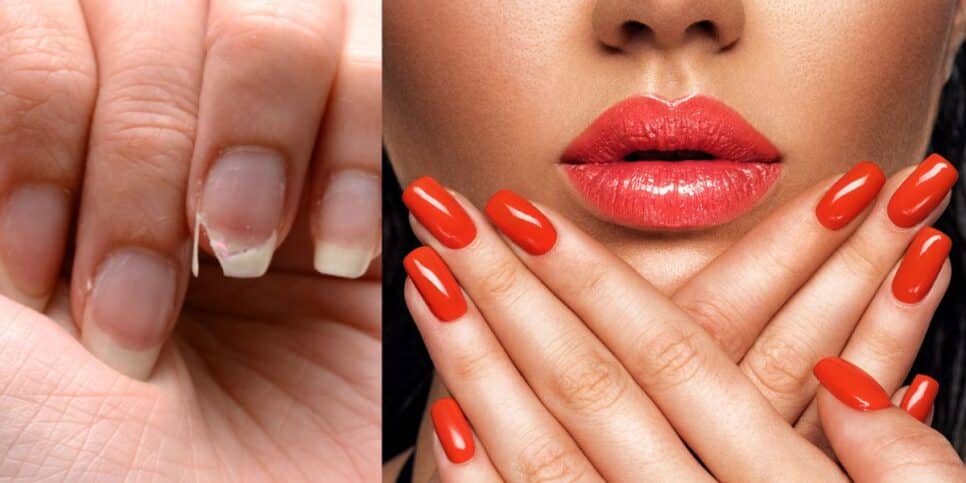 Unhas quebradas e mulher usando esmalte vermelho (Fotos: Reproduções / Canva)