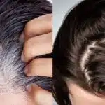 Receitinha caseira só com 4 ingredientes pra acabar com o cabelo branco - Foto: Internet