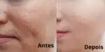 Dê adeus às rugas com essa harmonização facial caseira (Reprodução: Montagem TV Foco)