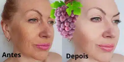 Mistura caseira com uva melhora a pele mesmo sem botox (Reprodução: Montagem TV Foco)