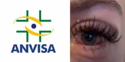 Anvisa crava proibição contra produto que pode causar cegueira (Foto: Reprodução/ Internet)