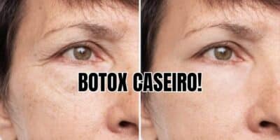 Botox caseiro dexa você 20 mais jovem e com pele mais linda que das famosas  - Foto: Internet