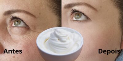 Imagem do post Fim das rugas e rostinho de 30: Misturinha com creme de leite e + 3 ingredientes traz resultado em 20 minutos