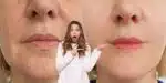 Harmonização facial acaba com as rugas em minutos (Reprodução: Montagem TV Foco)