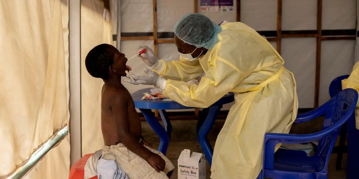 Mpox chega em situação de emergência global em 2024 (Reprodução/Expresso)