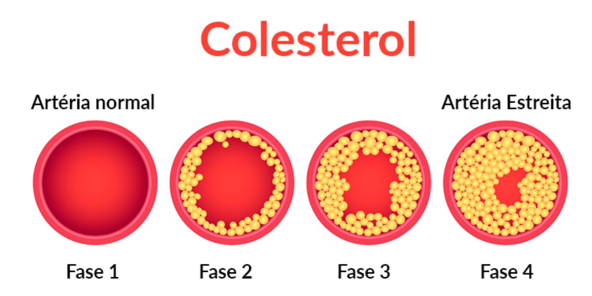 Colesterol (Reprodução/Unifesp)