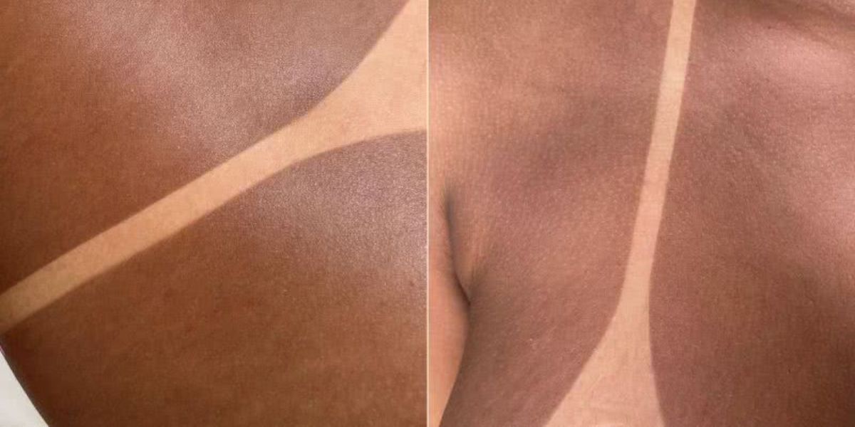 Tome cuidado com o risco de câncer com o bronzeamento artificial (Reprodução: Internet)