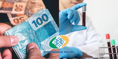 Imagem do post Para se aposentar em setembro: Brasileiros diagnosticados com essas doenças têm direito ao benefício do INSS