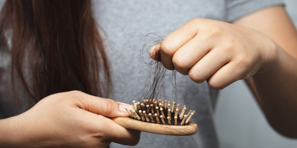 Cabelo, Alopecia