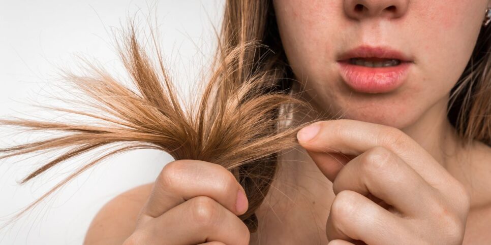 Cabelo Oleoso