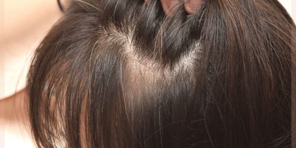 Adeus cabelo branco com essa receita natural (Foto: Montagem)