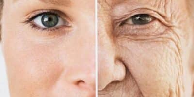 Basta 1 ingrediente pra rejuvenescer até 15 anos e ter o melhor colágeno natural - Foto: Internet